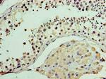 MON1A Antibody in Immunohistochemistry (Paraffin) (IHC (P))