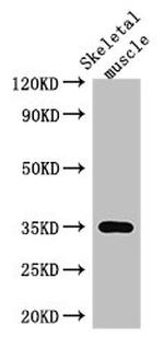 ANKRD23 Antibody in Western Blot (WB)