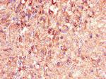 PHLDB2 Antibody in Immunohistochemistry (Paraffin) (IHC (P))
