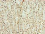 TRAPPC6B Polyclonal Antibody