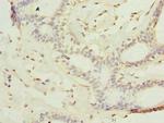 KATNAL2 Polyclonal Antibody