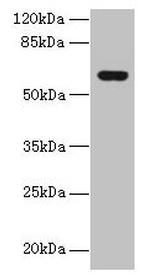 KATNAL2 Antibody in Western Blot (WB)