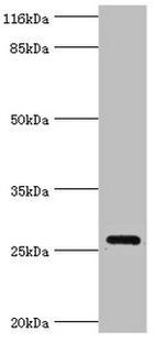 OFCC1 Polyclonal Antibody