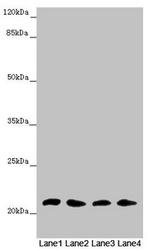 MSRB3 Polyclonal Antibody