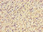 NIM1 Antibody in Immunohistochemistry (Paraffin) (IHC (P))