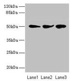 NIM1 Antibody in Western Blot (WB)