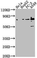 Tensin 4 Antibody in Western Blot (WB)