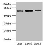 CCDC116 Antibody in Western Blot (WB)