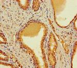CBWD2 Antibody in Immunohistochemistry (Paraffin) (IHC (P))