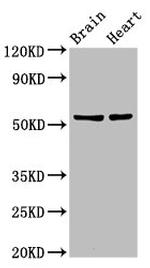 DRB1 Antibody in Western Blot (WB)