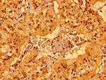 MCAT Polyclonal Antibody
