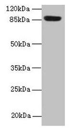 PASD1 Antibody in Western Blot (WB)