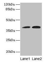 KLHDC8A Antibody in Western Blot (WB)