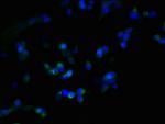 ZDHHC23 Polyclonal Antibody