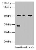 SLC38A6 Antibody in Western Blot (WB)