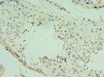 SPAG16 Polyclonal Antibody