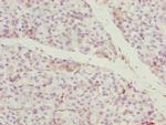 CCDC89 Polyclonal Antibody