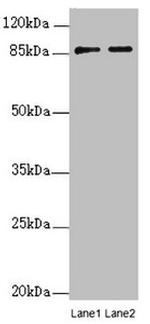 FAM48A Antibody in Western Blot (WB)