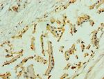 NLGN4Y Polyclonal Antibody