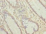 NUBPL Antibody in Immunohistochemistry (Paraffin) (IHC (P))