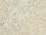 NUBPL Polyclonal Antibody