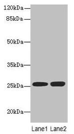 N6AMT2 Polyclonal Antibody