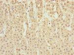 NORE1 Polyclonal Antibody