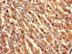 LPGAT1 Polyclonal Antibody