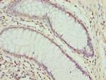 CPXCR1 Antibody in Immunohistochemistry (Paraffin) (IHC (P))