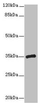 CPXCR1 Antibody in Western Blot (WB)