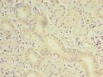OSR2 Polyclonal Antibody