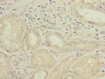 GALNT15 Polyclonal Antibody