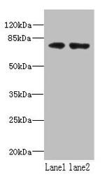 WDTC1 Polyclonal Antibody