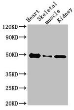 ATP6V1C2 Antibody in Western Blot (WB)