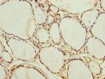 NEDD1 Polyclonal Antibody