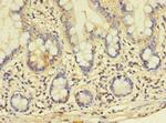 GALNT14 Antibody in Immunohistochemistry (Paraffin) (IHC (P))