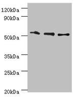 RMDN3 Antibody in Western Blot (WB)