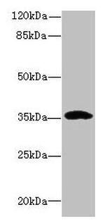 CCDC24 Antibody in Western Blot (WB)