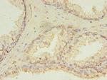HDDC3 Polyclonal Antibody
