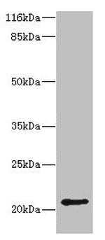 HDDC3 Antibody in Western Blot (WB)