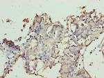 TTC9C Polyclonal Antibody