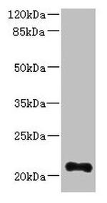 TTC9C Antibody in Western Blot (WB)