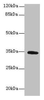 C5orf35 Polyclonal Antibody