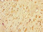 SLC30A7 Polyclonal Antibody