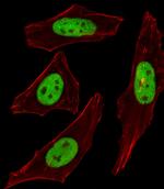 SUMO2/SUMO3 Antibody in Immunocytochemistry (ICC/IF)