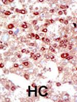 SUMO2/SUMO3 Antibody in Immunohistochemistry (Paraffin) (IHC (P))