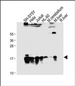 SUMO2/SUMO3 Antibody in Western Blot (WB)