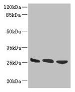 DNAJB8 Antibody in Western Blot (WB)