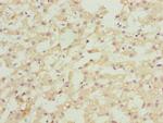 ASAP3 Antibody in Immunohistochemistry (Paraffin) (IHC (P))