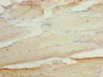 ASAP3 Polyclonal Antibody